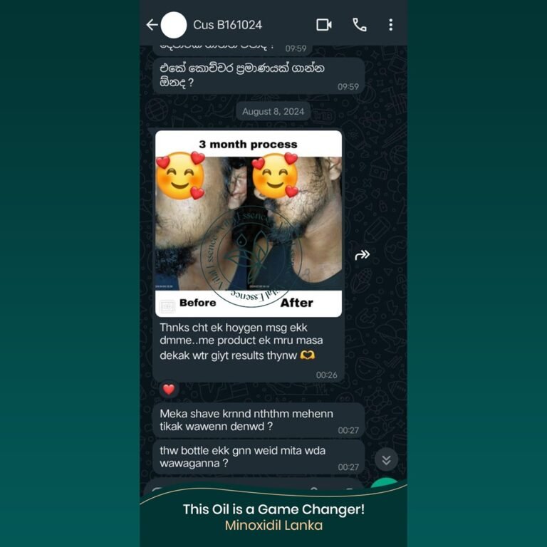 Minoxidil Testimonial