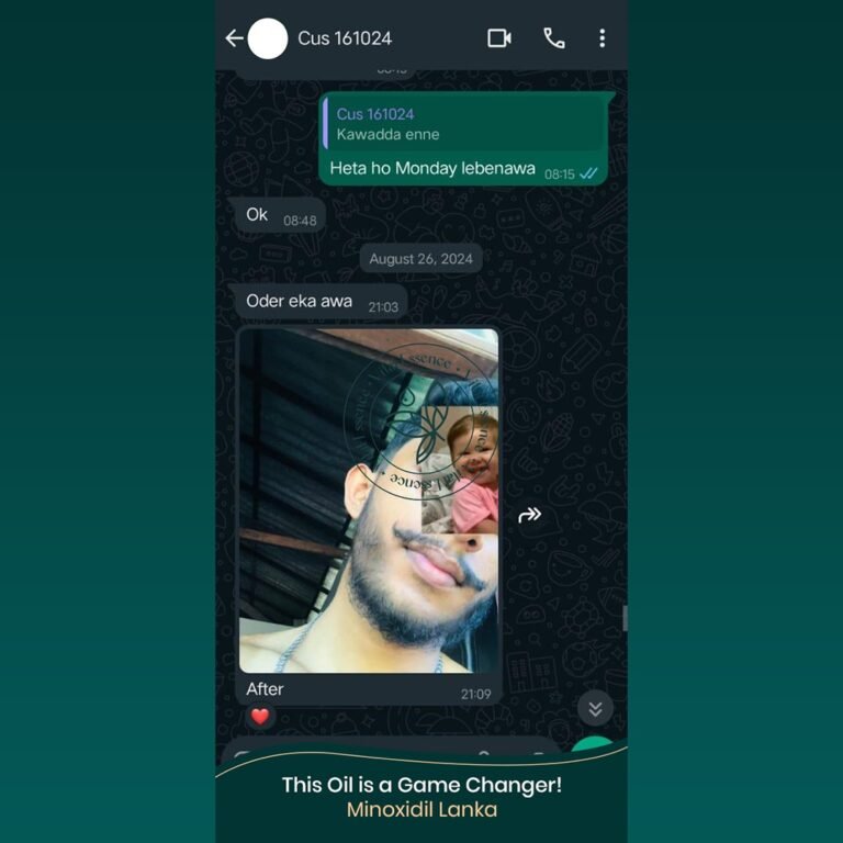 Minoxidil Testimonial
