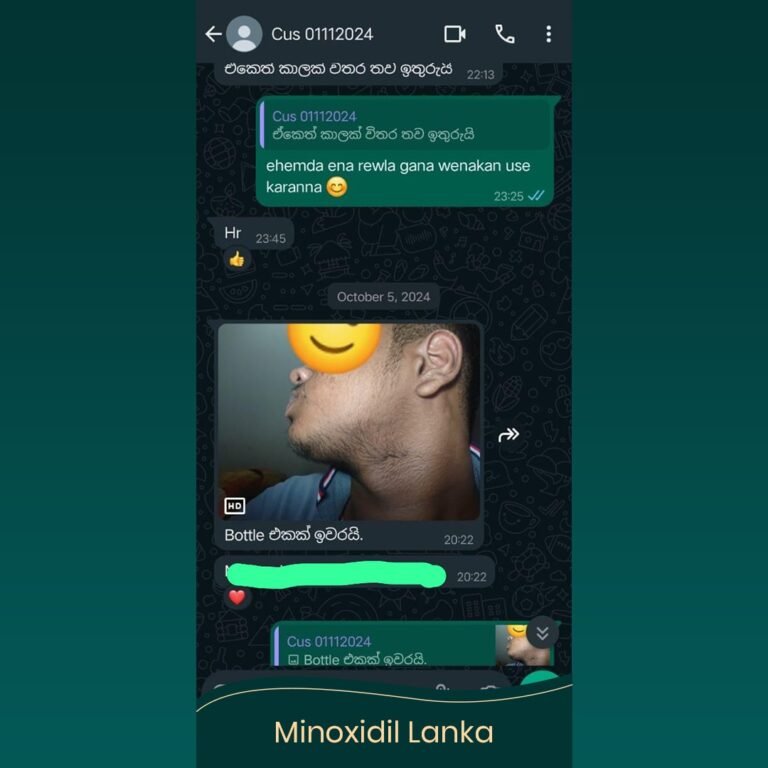 Minoxidil Testimonial