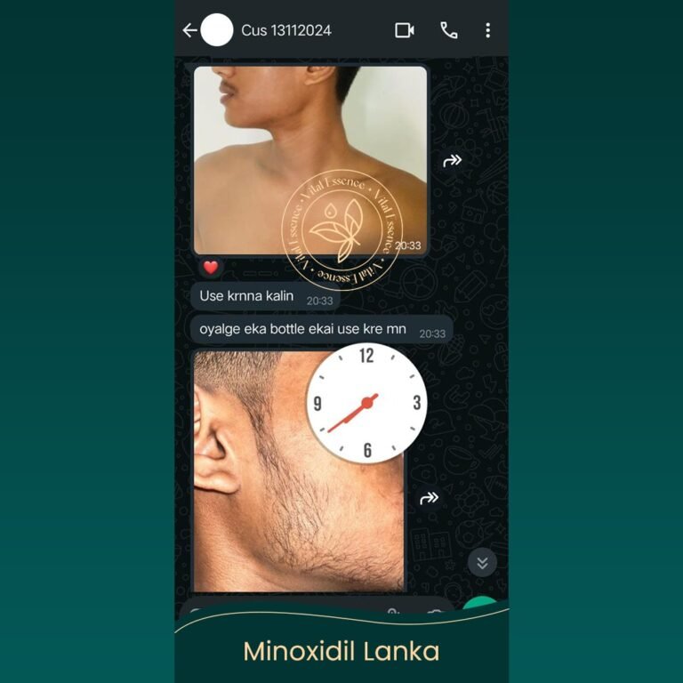 Minoxidil Testimonial